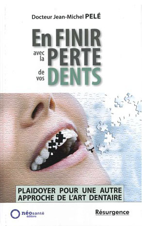 En finir avec la perte de vos dents